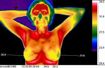Animated thermal imaging series showing
                      different conditions